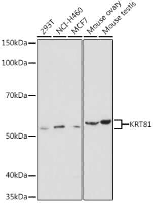 Western Blot: KRT81 Antibody [NBP3-04880] - Western blot analysis of extracts of various cell lines, using KRT81 antibody (NBP3-04880) at 1:1000 dilution. Secondary antibody: HRP Goat Anti-Rabbit IgG (H+L) at 1:10000 dilution. Lysates/proteins: 25ug per lane. Blocking buffer: 3% nonfat dry milk in TBST. Detection: ECL Basic Kit. Exposure time: 30s.